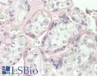 IHC-plus™ CD274 / B7-H1 / PD-L1 Antibody