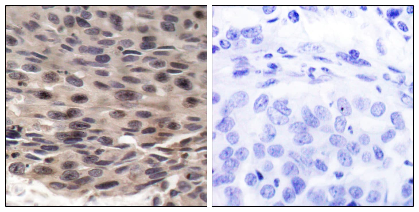 EIF4EBP1 / 4EBP1 Antibody (phospho-Thr36)