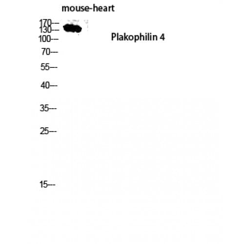 PKP4 / Plakophilin 4 Antibody (160-240 aa, Internal)