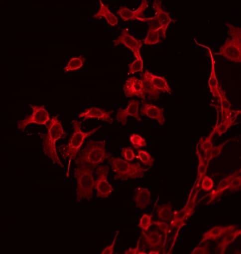 CD19 Antibody (phospho-Tyr531)