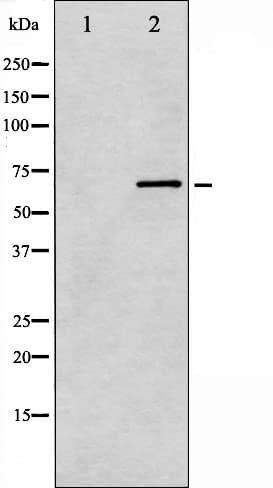 Polyclonal Rabbit anti-Human PRKCB / PKC-Beta Antibody (phospho-Ser661, IF, WB)
