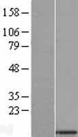 SMDT1 / C22orf32 Protein (Over-Expression Lysate Myc-DDK (Flag))