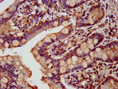 GATAD2A Antibody