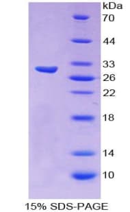 Human ZNF384 Protein (Recombinant His-T7)