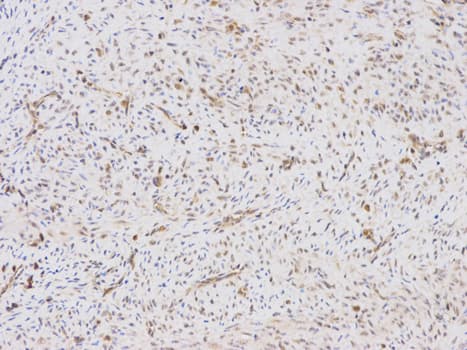 IHC-plus™ LY96 / MD2 / MD-2 Antibody
