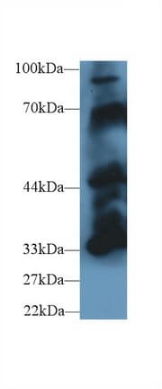 PTPN5 / STEP Antibody