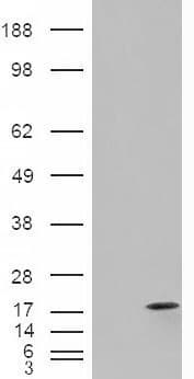 IHC-plus™ I-FABP / FABP2 Antibody (aa121-132)