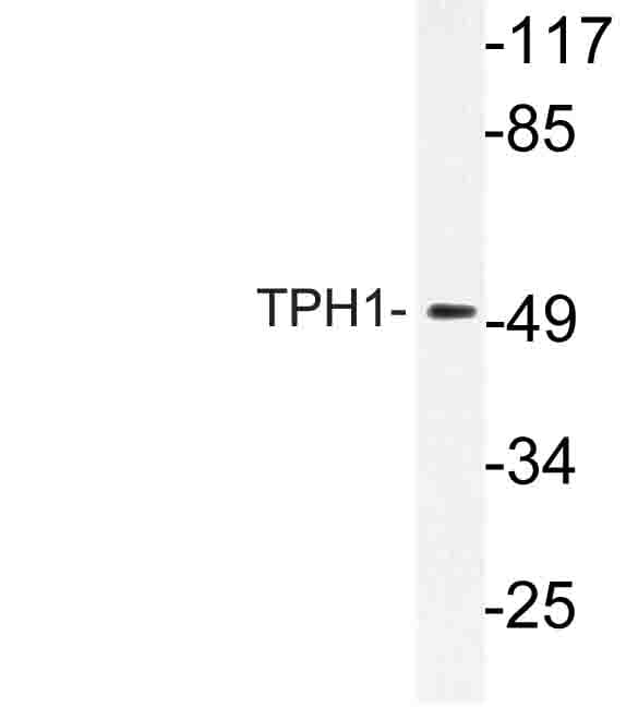 TPH1 / Tryptophan Hydroxylase Antibody (Val256)