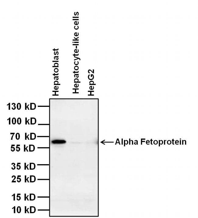 Alpha-Fetoprotein Antibody (clone P5B8)