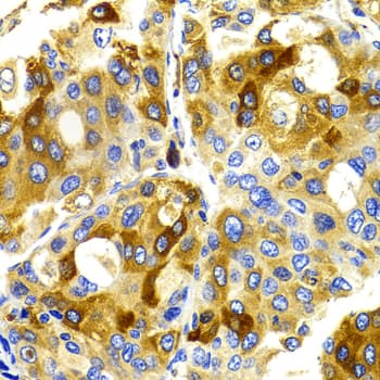 CDK20 / CCRK Antibody