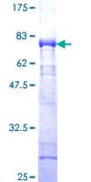 Human CAMK1 / CAMKI Protein (Recombinant GST)