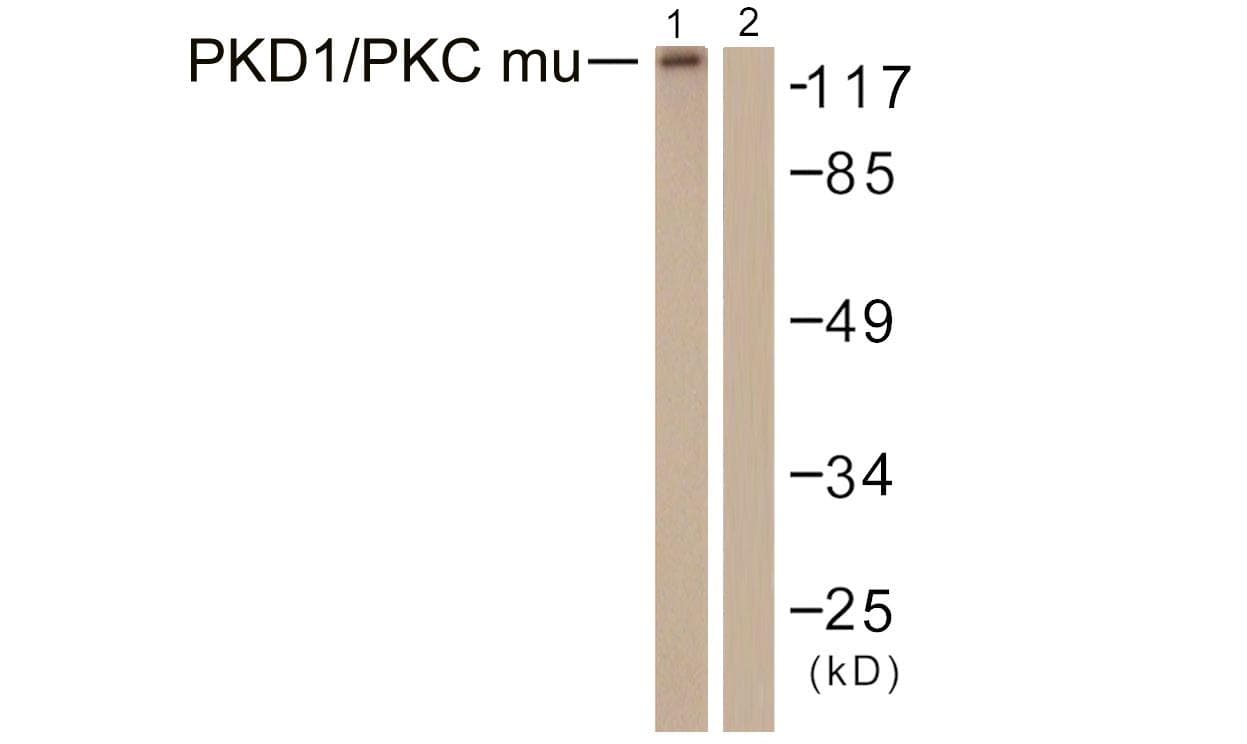 Polyclonal Rabbit anti-Human PRKD1 / PKC Mu Antibody (p463, IHC, WB)