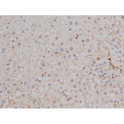 Polyclonal Rabbit anti-Human LYN Antibody (phospho-Tyr508, IHC, IF, WB)