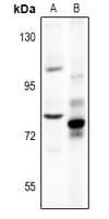 CHGB / Chromogranin B Antibody