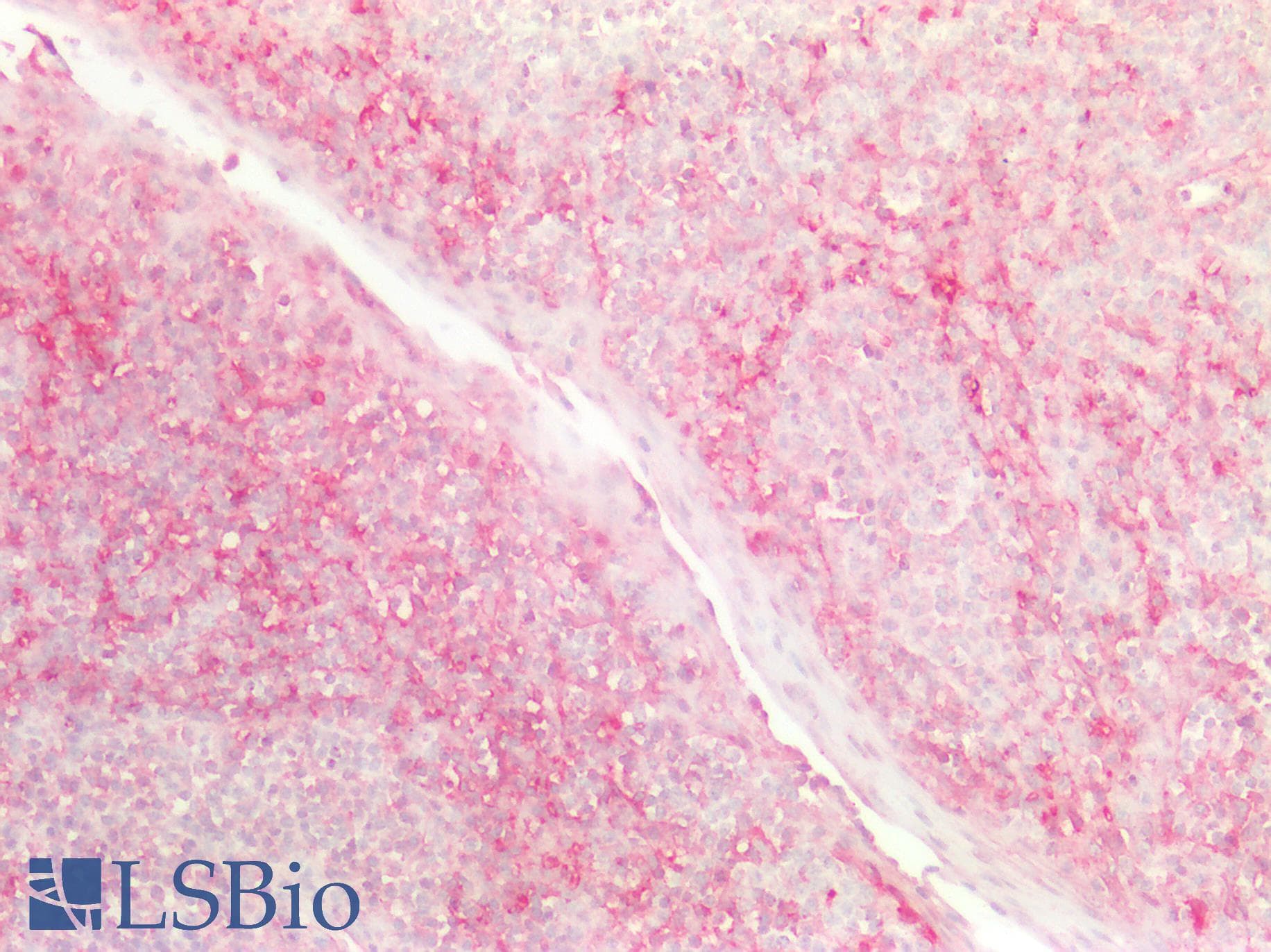 PathPlus™ NDRG1 Antibody