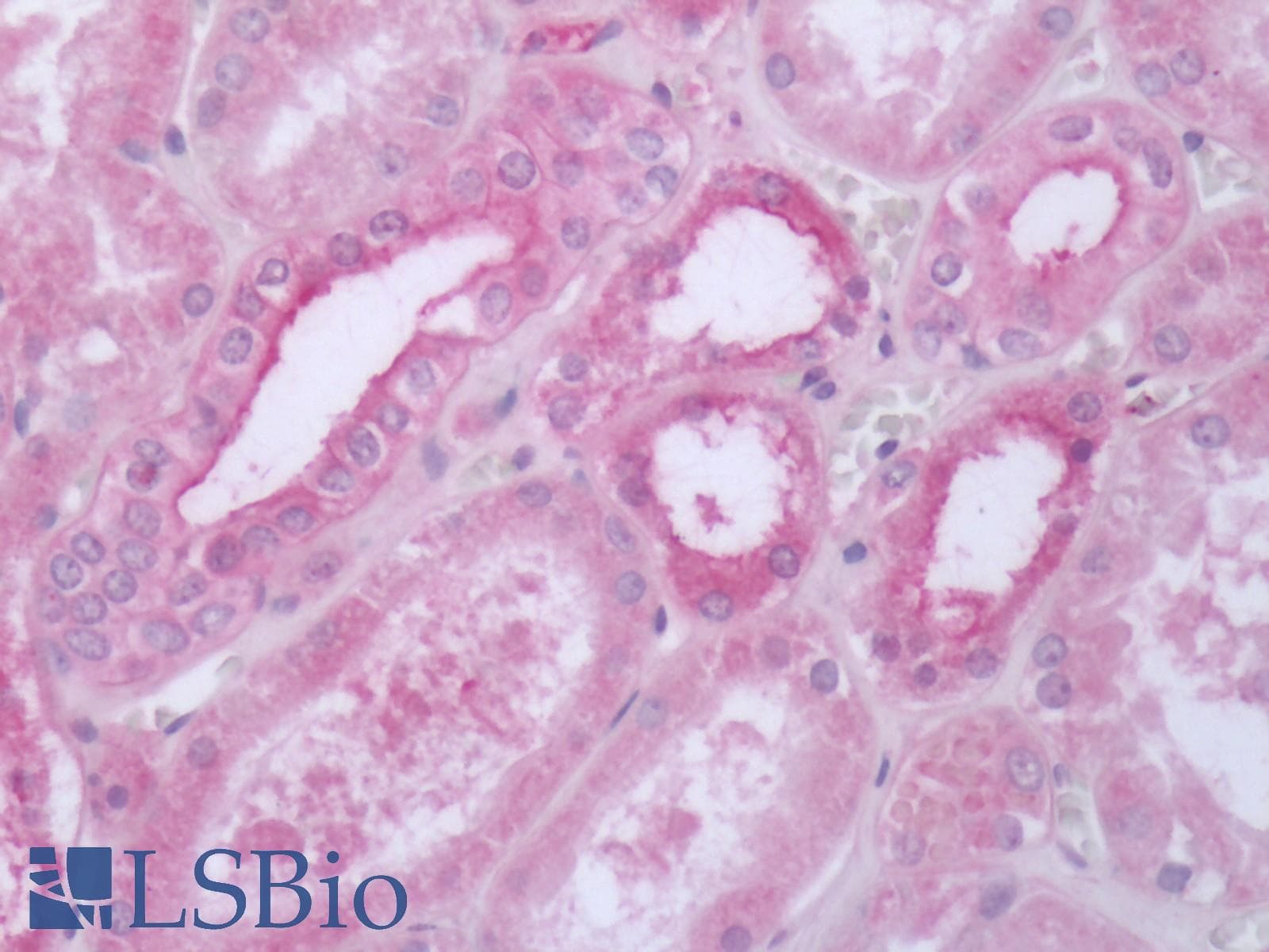 IHC-plus™ Polyclonal Rabbit anti-Human HTR1D / 5-HT1D Receptor Antibody (Cytoplasmic Domain, IHC)