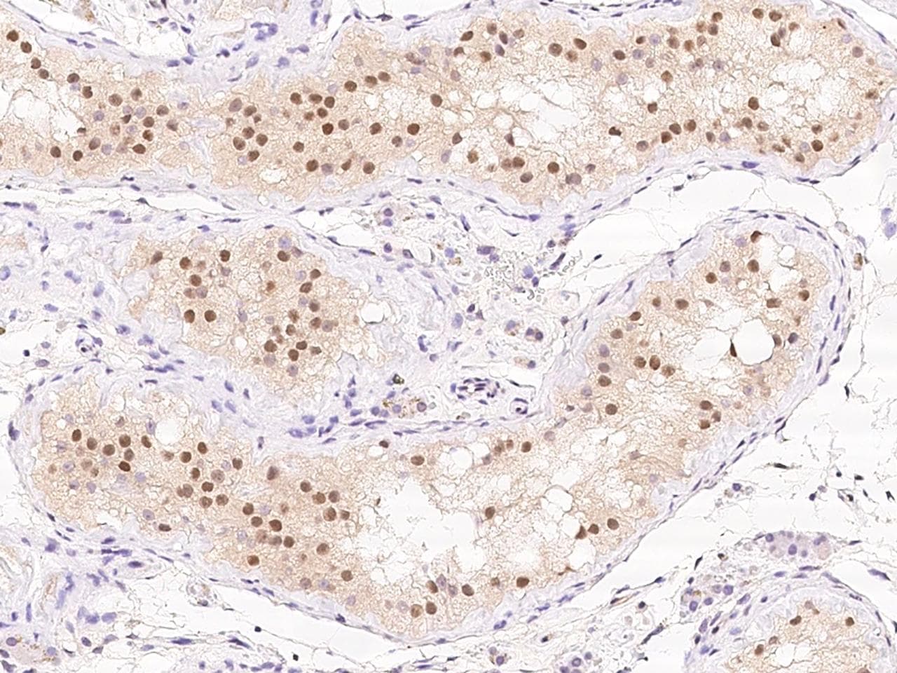 TUSC1 Antibody