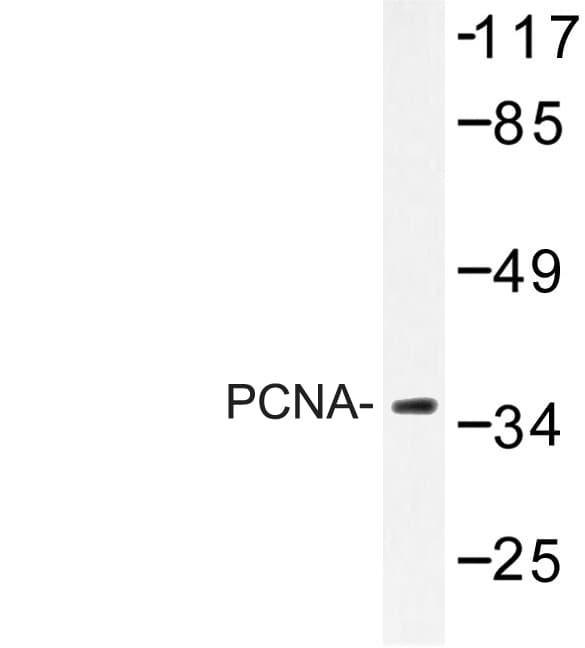 Polyclonal Rabbit anti-Human PCNA Antibody (Ile88, IHC, WB)