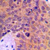 MINPP1 Antibody (Internal)