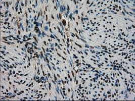 Monoclonal Mouse anti-Human STK39 / SPAK Antibody (clone OTI2E10, IHC, WB)