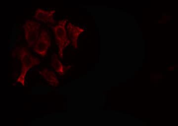 Polyclonal Rabbit anti-Human MMP23 Antibody (IF, WB)