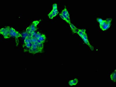 PTCH2 / Patched 2 Antibody
