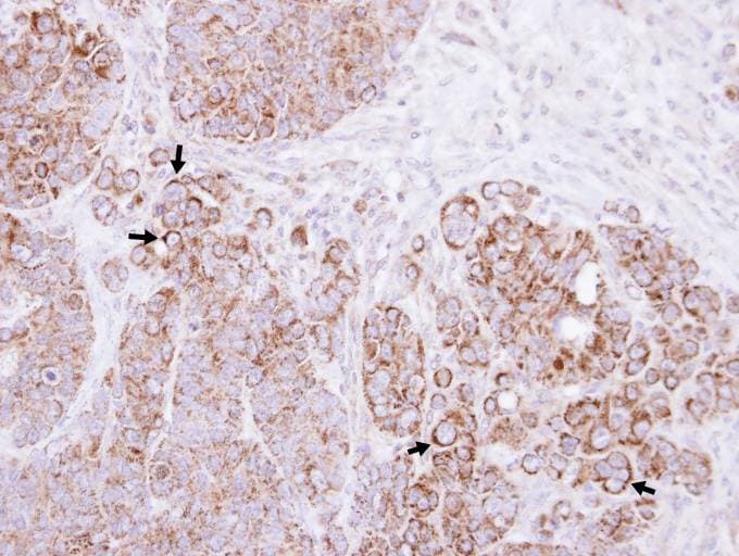 CLLP / CTNNAL1 Antibody (aa292-563)