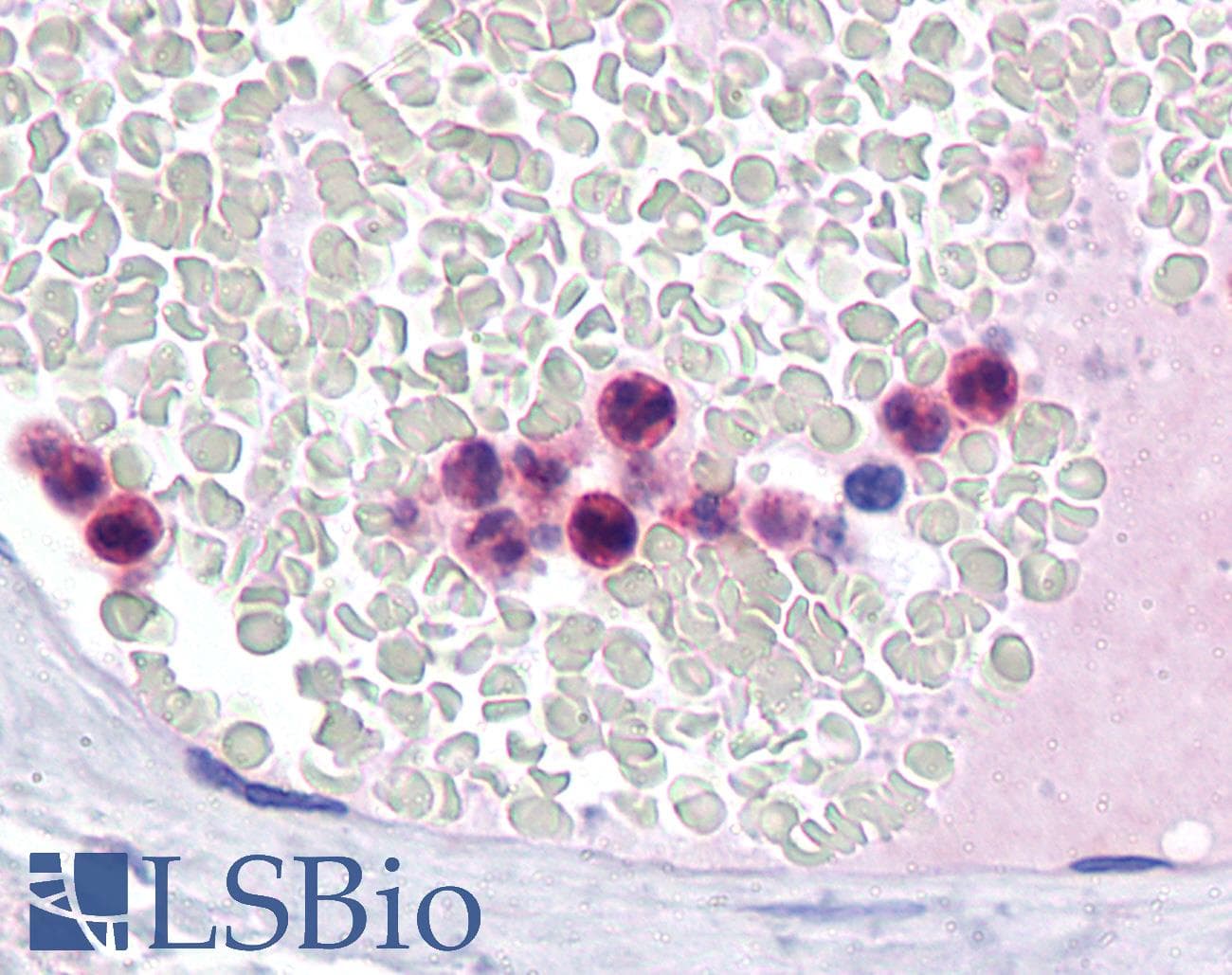 IHC-plus™ IRF4 Antibody (clone 2F2)