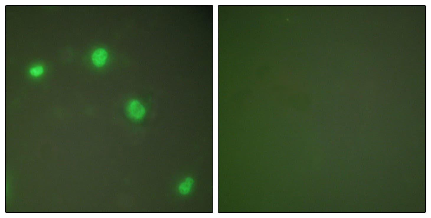 Polyclonal Rabbit anti-Human XRCC6 / Ku70 Antibody (aa560-609, IHC, IF, WB)