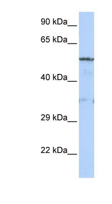 LIPG / Endothelial Lipase Antibody (C-Terminus)