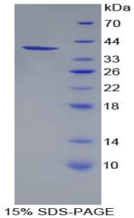 Mouse PPY / Pancreatic Polypeptide Protein (Recombinant His-GST)