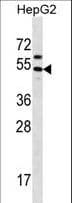 GRHL1 / TFCP2L2 Antibody (aa294-322)