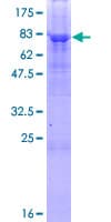 Human PNPLA3 / Adiponutrin Protein (Recombinant GST)