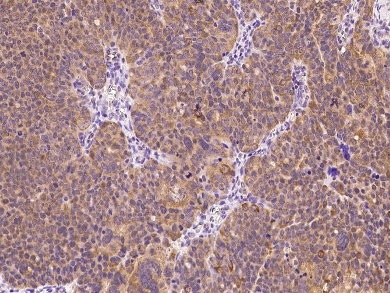 E6AP / UBE3A Antibody