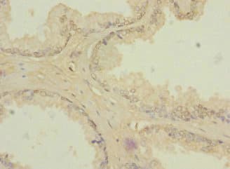 ZIC3 Antibody