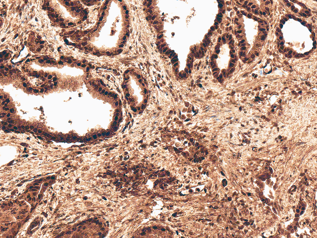 ROR2 Antibody (PerCP)