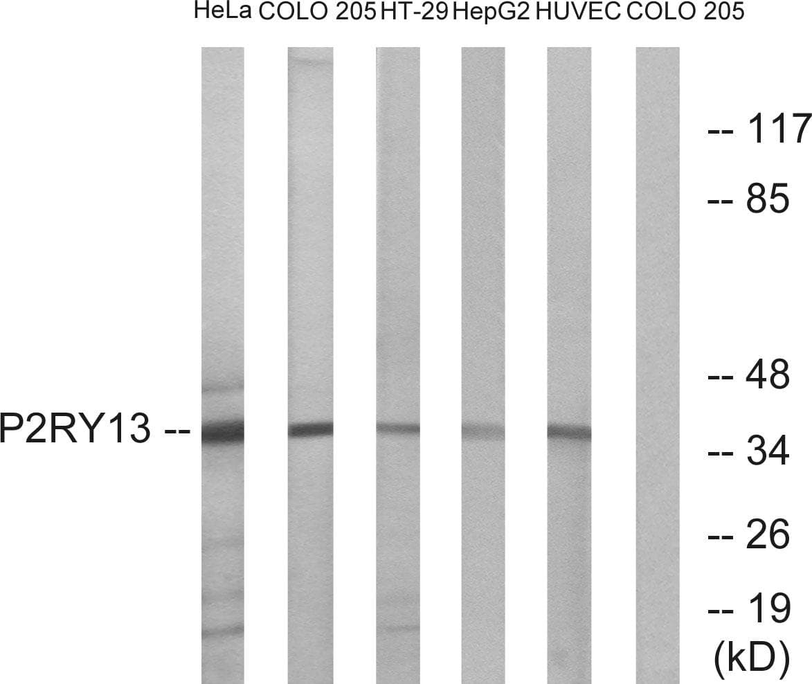 Polyclonal Rabbit anti-Human P2Y13 / P2RY13 Antibody (WB)