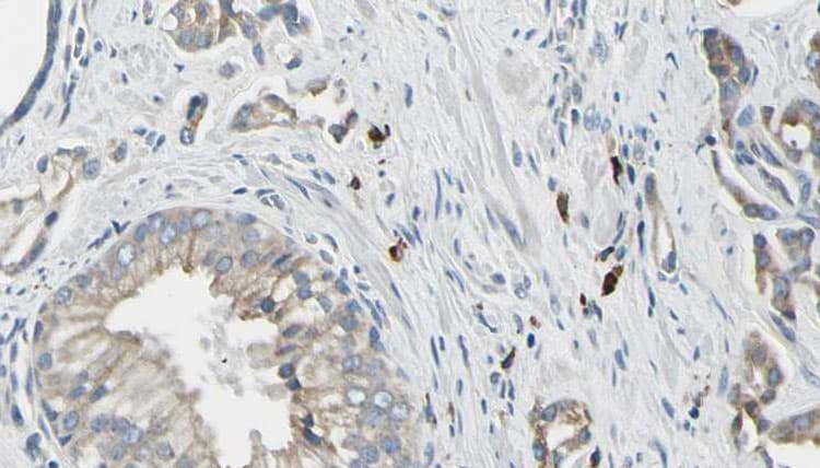 Polyclonal Rabbit anti-Human STEAP1 / STEAP Antibody (IHC, WB)