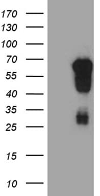 EVX1 Antibody (aa1-244, clone OTI1F4, Carrier-free)