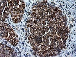 SSR1 Antibody (clone OTI3E5)