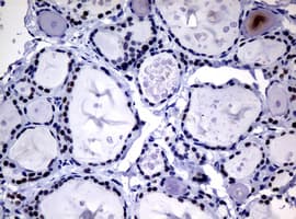 NBN / Nibrin Antibody (clone OTI2E10)