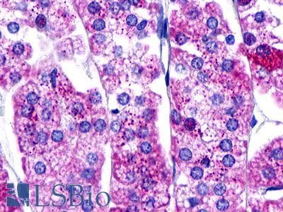 PathPlus™ GnRH receptor / GNRHR Antibody (Cytoplasmic Domain)