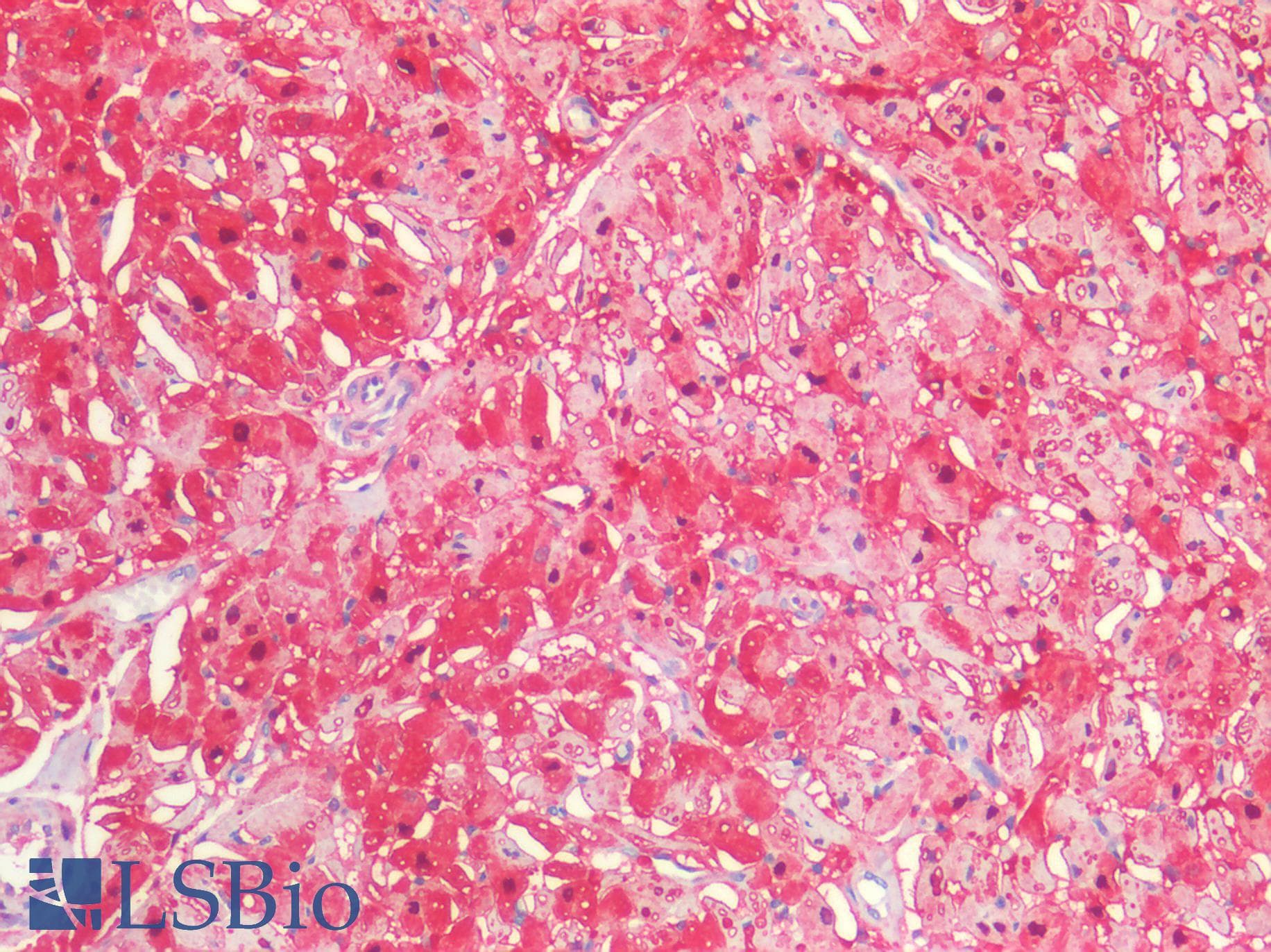IHC-plus™ S100A1 / S100-A1 Antibody (Internal)
