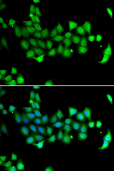 HSP70L1 / HSPA14 Antibody