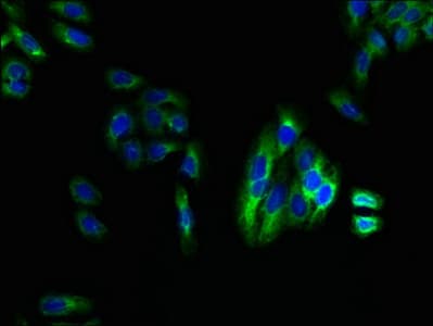 LPAR4 / GPR23 Antibody
