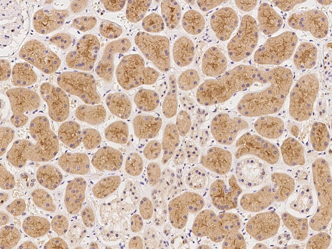 CAPN10 / Calpain 10 Antibody