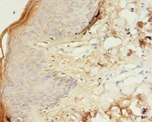 TM4SF6 / TSPAN6 Antibody