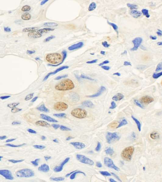 SETD1A / SET1 Antibody (aa1200-1250)