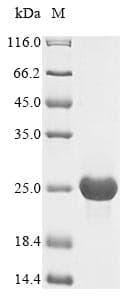 Cytomegalovirus UL128 Protein (Recombinant 6His, N-terminus)