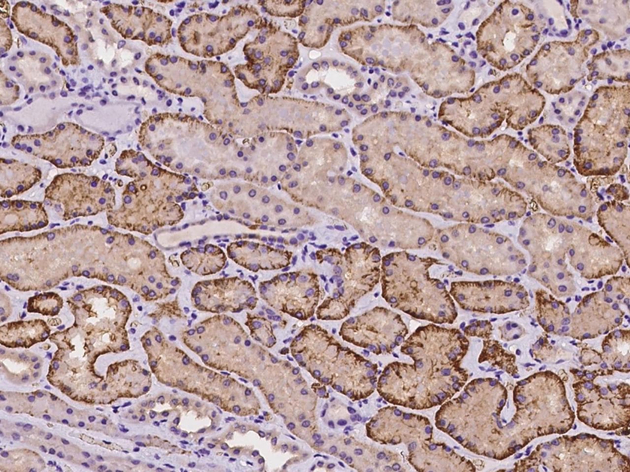 FRMD7 Antibody